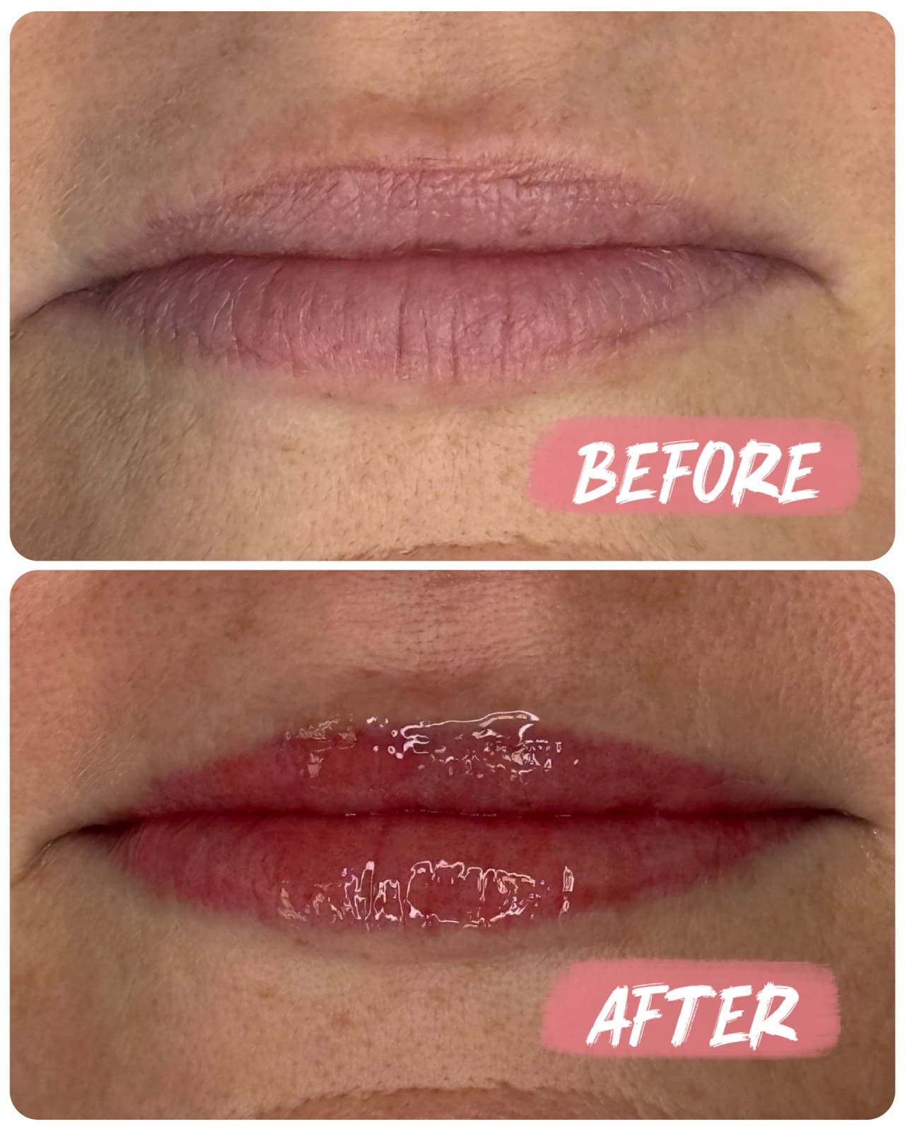 Lip color before and immediately after a lip blush session. The after image shows fresh, unhealed color.